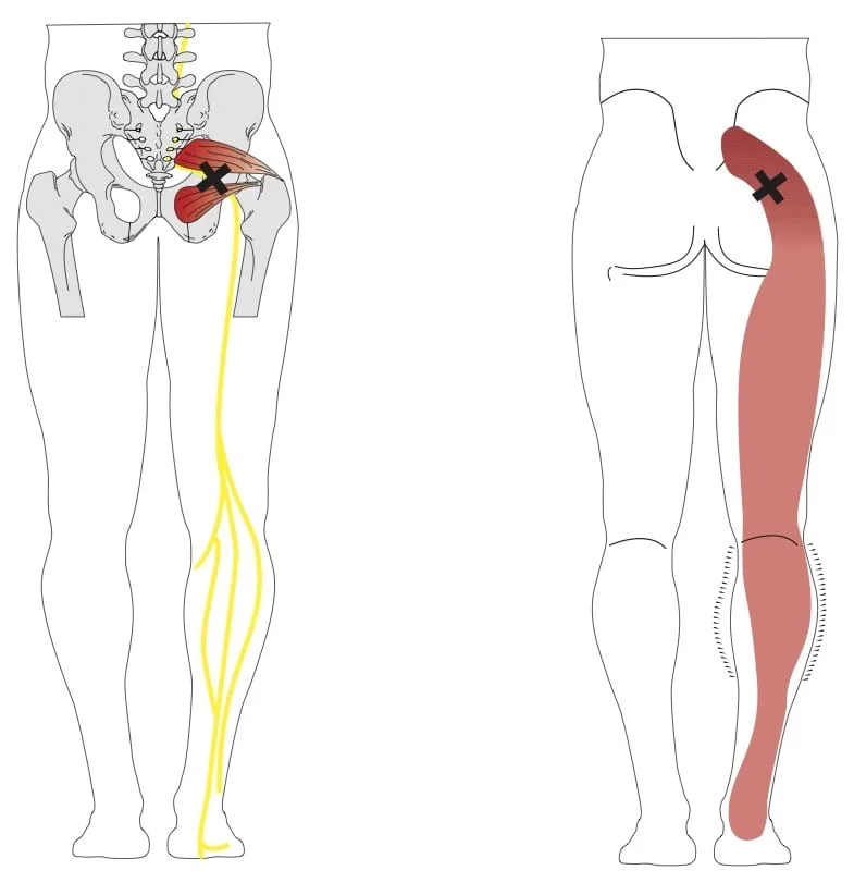 Piriformis muscle anatomy diagram showing its position relative to the sciatic nerve in the buttock