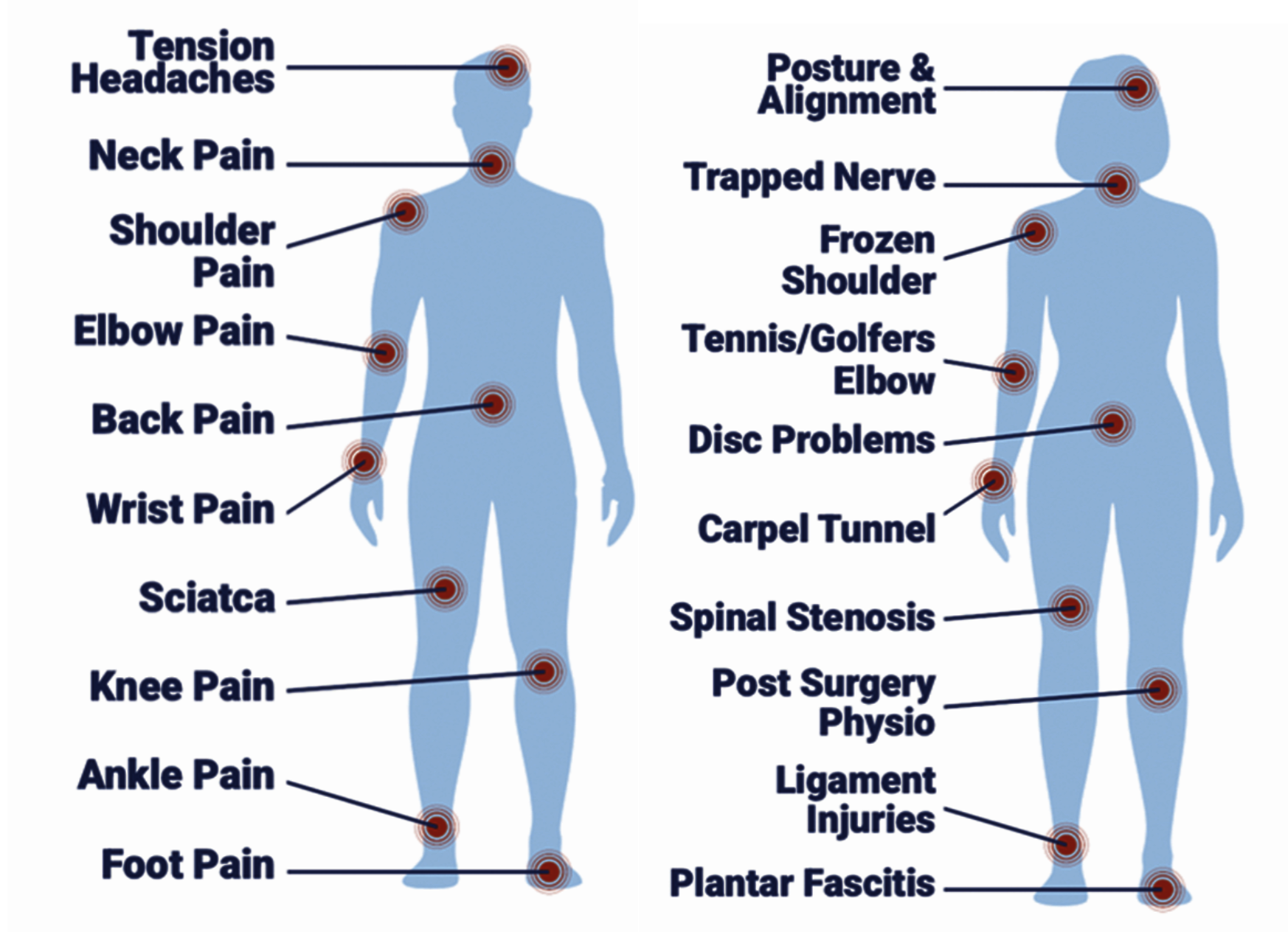 List of conditions Physiotherapists and Osteopaths Treat