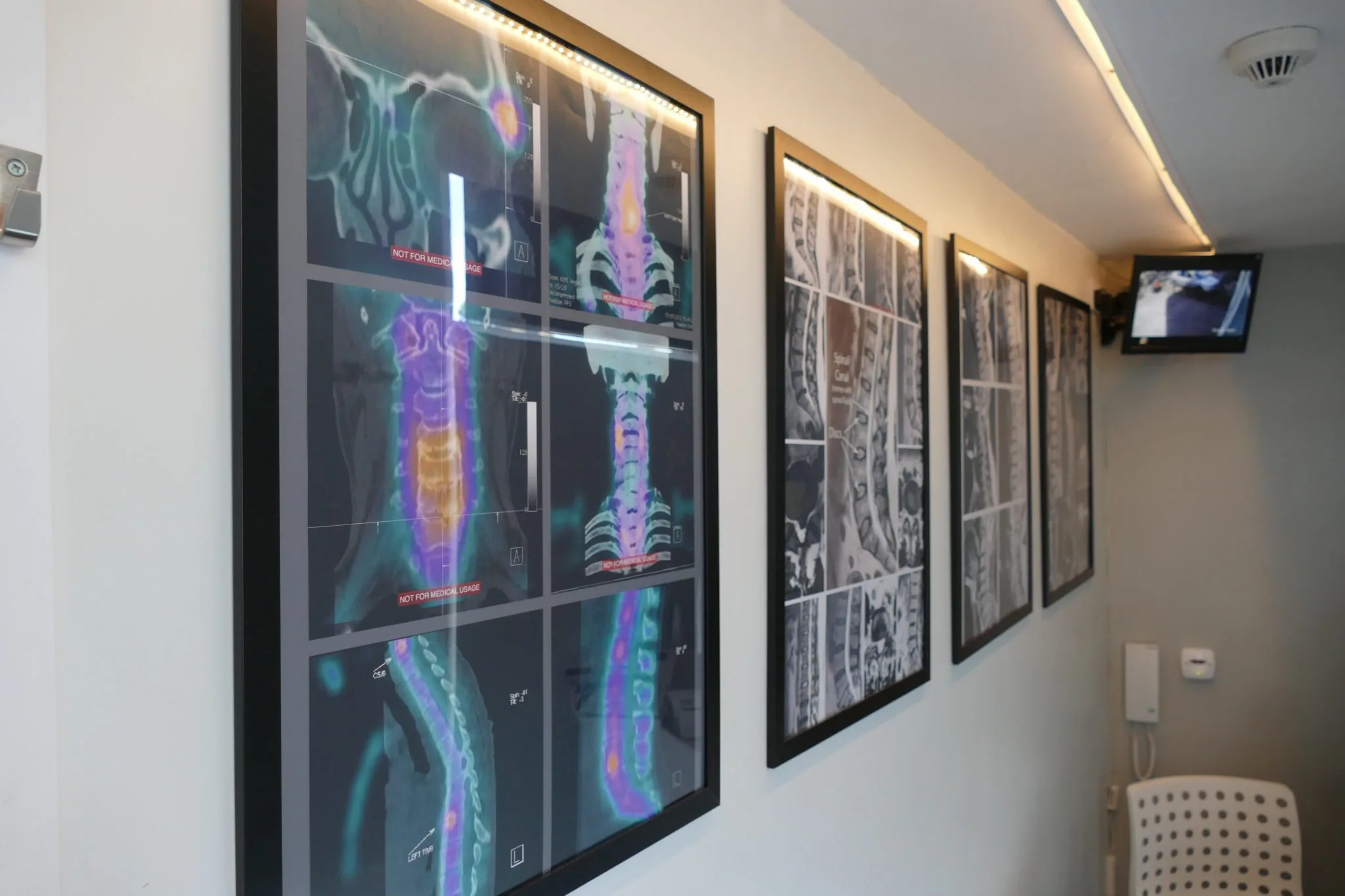 Spinal Assessment Clinic